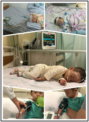 Điện cực hút điện cực EKG đa năng 40421A cho chuối 4.0 Din 3.0 Snap